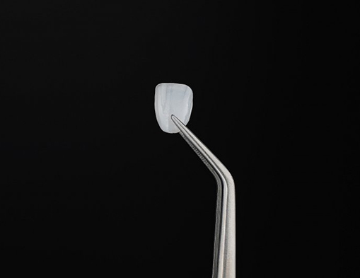 Veneer held with tweezers
